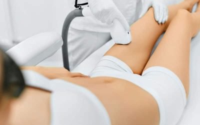 IPL laser hair removal