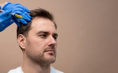 PRP Treatment for Hair Rejuvenation